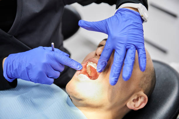 Best Emergency Broken Tooth Repair in Adams, WI